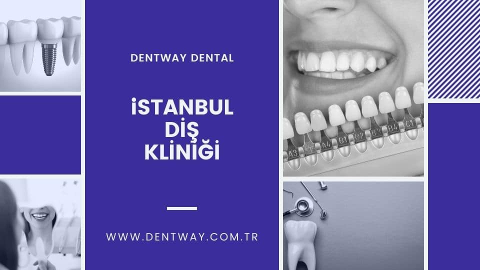 Diş implantı nereden yaptırılır