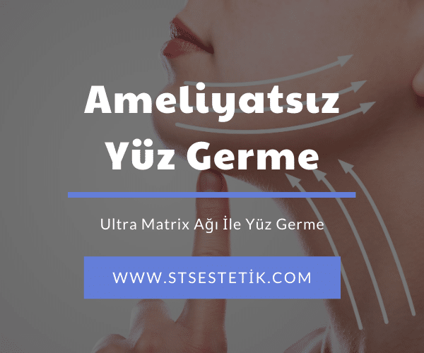Yüz germe